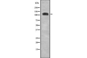 Western blot analysis of C/EBP ζ using COLO205 whole cell lysates (CEBPZ anticorps  (N-Term))