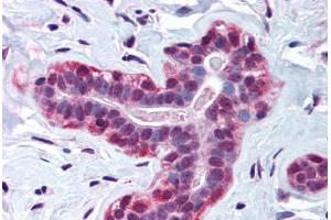 Human Breast (formalin-fixed, paraffin-embedded) stained with WRNIP1 antibody ABIN214570 at 3 ug/ml followed by biotinylated goat anti-rabbit IgG secondary antibody ABIN481713, alkaline phosphatase-streptavidin and chromogen.