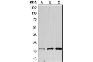 Western blot analysis of DNAL1 expression in HEK293T (A), mouse testis (B), rat kidney (C) whole cell lysates. (DNAL1 anticorps  (Center))