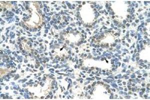 Immunohistochemical staining (Formalin-fixed paraffin-embedded sections) of human lung with HOXC9 polyclonal antibody  at 4-8 ug/mL working concentration. (HOXC9 anticorps  (Internal Region))