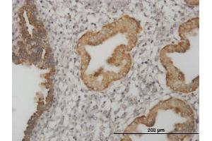 Immunoperoxidase of monoclonal antibody to MSI1 on formalin-fixed paraffin-embedded human endometrium.