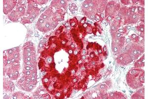 Rabbit Anti-PHGDH antibody Catalog Number: ARP54801 Formalin Fixed Paraffin Embedded Tissue: Human Pancreas Primary antibody Concentration: 1:100 Secondary Antibody: Donkey anti-Rabbit-Cy3 Secondary Antibody Concentration: 1:200 Magnification: 20x Exposure Time: 0.