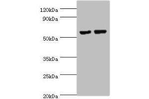 Western blot All lanes: MATN3 antibody at 14 μg/mL Lane 1: NIH/3T3 whole cell lysate Lane 2: Mouse thymus tissue Secondary Goat polyclonal to rabbit IgG at 1/10000 dilution Predicted band size: 53, 49 kDa Observed band size: 53 kDa (Matrilin 3 anticorps  (AA 277-486))