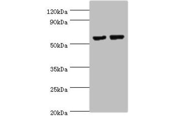 Matrilin 3 anticorps  (AA 277-486)