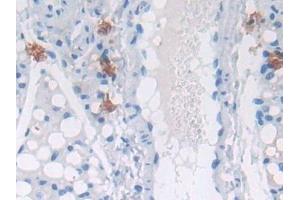 Detection of GaA in Mouse Skeletal muscle Tissue using Polyclonal Antibody to Glucosidase Alpha, Acid (GaA)