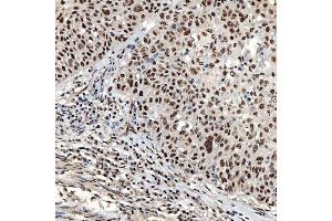 IHC analysis of SNRNP40 using anti-SNRNP40 antibody (ABIN7601719). (SNRNP40 anticorps  (AA 43-357))