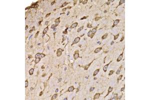 Immunohistochemistry of paraffin-embedded mouse brain using RPS14 antibody (ABIN5974066) at dilution of 1/100 (40x lens). (RPS14 anticorps)