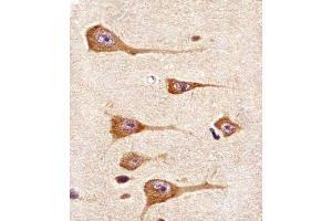 Paraformaldehyde-fixed, paraffin embedded human brain tissue, Antigen retrieval by boiling in sodium citrate buffer (pH6.