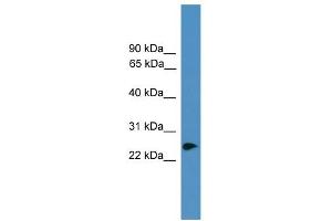 WB Suggested Anti-ZNF313 Antibody Titration:  0.
