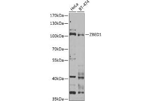 Western blot analysis of extracts of various cell lines, using ZBED1 Antibody (ABIN6132791, ABIN6150363, ABIN6150364 and ABIN6222539) at 1:1000 dilution.