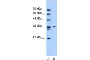 Western Blotting (WB) image for anti-Solute Carrier Family 35 (UDP-N-Acetylglucosamine (UDP-GlcNAc) Transporter), Member A3 (SLC35A3) antibody (ABIN2462748)