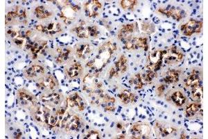 IHC-P: AQP1 antibody testing of rat kidney tissue (Aquaporin 1 anticorps  (C-Term))