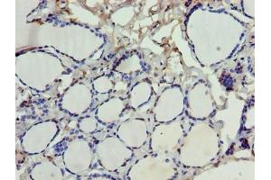 Immunohistochemistry of paraffin-embedded human thyroid tissue using ABIN7168881 at dilution of 1:100
