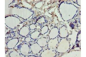 Immunohistochemistry of paraffin-embedded human thyroid tissue using ABIN7168881 at dilution of 1:100 (SDSL anticorps  (AA 39-169))