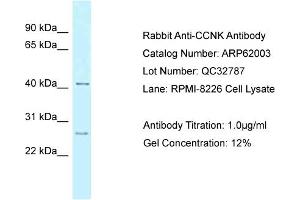 Western Blotting (WB) image for anti-Cyclin K (CCNK) (Middle Region) antibody (ABIN2788983) (Cyclin K anticorps  (Middle Region))