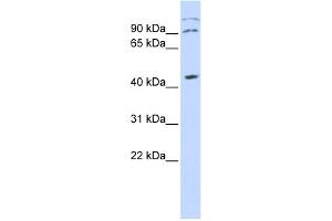 WB Suggested Anti-ZFX Antibody Titration:  0. (ZFX anticorps  (Middle Region))
