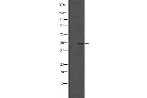 Western blot analysis of SOX4 expression in Hela cell lysate,The lane on the left is treated with the antigen-specific peptide.