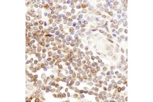 Immunohistochemistry (IHC) image for anti-CD7 (CD7) (AA 190-240) antibody (ABIN7455031)
