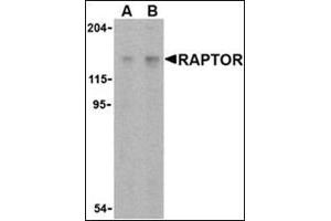 Western blot analysis of Raptor in L1210 cell lysate with this product at (A) 2 and (B) 4 μg/ml.