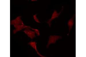 ABIN6275379 staining Hela by IF/ICC.