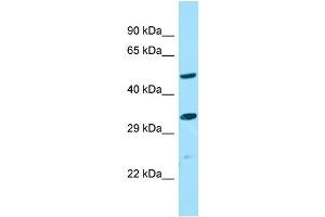 WB Suggested Anti-ALG10B Antibody Titration: 1. (ALG10B anticorps  (Middle Region))