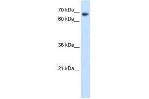 WB Suggested Anti-TAF6 Antibody Titration:  1.