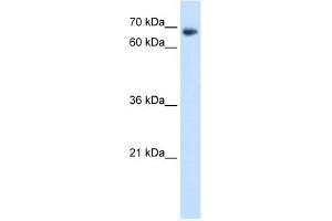 WB Suggested Anti-TAF6 Antibody Titration:  1. (TAF6 anticorps  (N-Term))