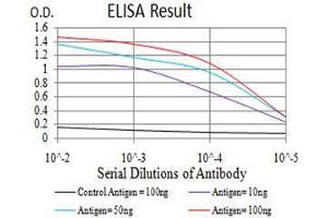 Black line: Control Antigen (100 ng),Purple line: Antigen (10 ng), Blue line: Antigen (50 ng), Red line:Antigen (100 ng) (GFPT1 anticorps  (AA 536-681))