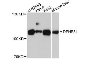 Western blot analysis of extracts of various cell lines, using WHRN antibody. (DFNB31 anticorps  (AA 708-907))