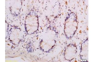 Formalin-fixed and paraffin embedded human rectal tissue labeled with Anti-Adiponectin Receptor 1 Polyclonal Antibody , Unconjugated at 1:300, followed by conjugation to the secondary antibody and DAB staining
