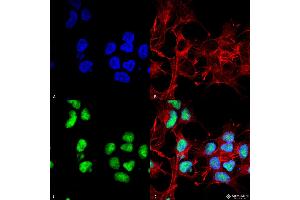 Immunocytochemistry/Immunofluorescence analysis using Rabbit Anti-Choline Acetyltransferase Polyclonal Antibody . (Choline Acetyltransferase anticorps  (N-Term) (HRP))