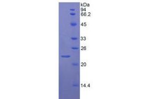 SDS-PAGE analysis of Rat vWF Protein. (VWF Protéine)