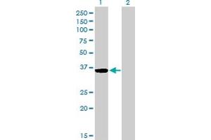 Western Blot analysis of GSC expression in transfected 293T cell line by GSC monoclonal antibody (M03), clone 3D11. (GSC anticorps  (AA 151-257))