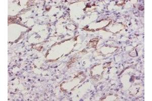 Immunohistochemistry of paraffin-embedded human kidney tissue using ABIN7177879 at dilution of 1:10
