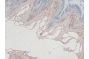 Detection of GFM1 in Mouse Skin Tissue using Polyclonal Antibody to G-Elongation Factor, Mitochondrial 1 (GFM1)