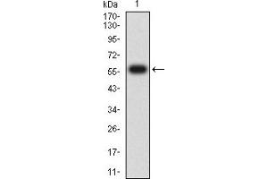 Western blot analysis using CD1C mAb against human CD1C (AA: extra 18-302) recombinant protein. (CD1c anticorps  (AA 18-302))