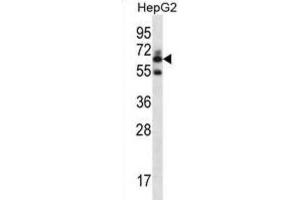 Western Blotting (WB) image for anti-gamma-Glutamyltransferase 2 (gGT2) antibody (ABIN2996985) (gGT2 anticorps)