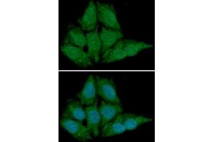 ICC/IF analysis of BLyS in HeLa cells line, stained with DAPI (Blue) for nucleus staining and monoclonal anti-human BLyS antibody (1:100) with goat anti-mouse IgG-Alexa fluor 488 conjugate (Green)