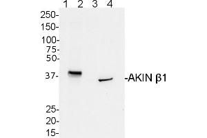 Image no. 1 for anti-SNF1-Related Protein Kinase Regulatory Subunit beta-1 (AKINBETA1) (Regulatory Subunit beta) antibody (ABIN488525)