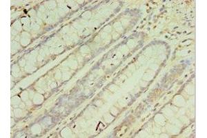 Immunohistochemistry of paraffin-embedded human colon tissue using ABIN7149543 at dilution of 1:100 (CRADD anticorps  (AA 1-199))