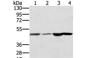 Western Blot analysis of Human fetal brain and normal liver tissue, Human normal kidney tissue and hepg2 cell using RNH1 Polyclonal Antibody at dilution of 1:400 (RNH1 anticorps)