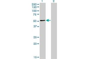 Western Blot analysis of ZNF323 expression in transfected 293T cell line by ZNF323 monoclonal antibody (M03), clone 4F7. (Zinc Finger and SCAN Domain Containing 31 (ZSCAN31) (AA 1-209) anticorps)