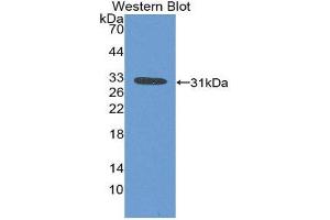 Western Blotting (WB) image for anti-Ficolin (Collagen/fibrinogen Domain Containing) 1 (FCN1) (AA 25-279) antibody (ABIN3207864) (FCN1 anticorps  (AA 25-279))