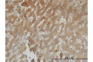 Immunoperoxidase of monoclonal antibody to AKR1C4 on formalin-fixed paraffin-embedded human liver tissue.
