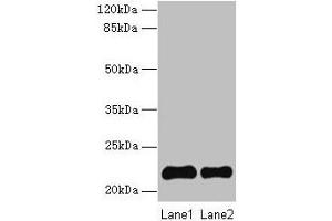 Western blot All lanes: SIRPD antibody at 14 μg/mL Lane 1: 293T whole cell lysate Lane 2: Mouse spleen tissue Secondary Goat polyclonal to rabbit IgG at 1/10000 dilution Predicted band size: 22 kDa Observed band size: 22 kDa (SIRPD anticorps  (AA 30-197))