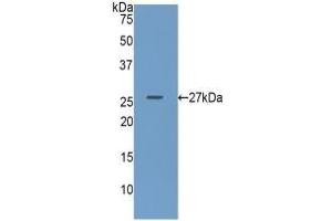 Detection of Recombinant GUSb, Human using Polyclonal Antibody to Glucuronidase Beta (GUSb) (Glucuronidase beta anticorps  (AA 451-649))