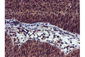 Image no. 7 for anti-EPM2A (Laforin) Interacting Protein 1 (EPM2AIP1) antibody (ABIN1498045) (EPM2AIP1 anticorps)