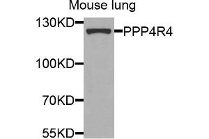 Western blot analysis of extracts of mouse lung cells, using PPP4R4 antibody. (PPP4R4 anticorps)