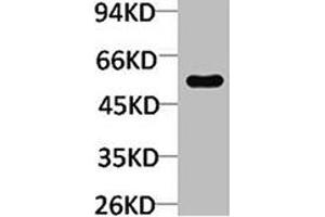 Western blot analysis of Mouse skeletal muscle using TRIM72 Polyclonal Antibody. (TRIM72 anticorps)