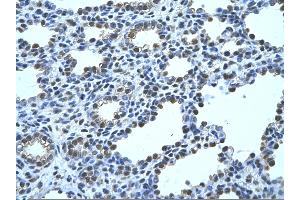 Rabbit Anti-FBP1 Antibody       Paraffin Embedded Tissue:  Human alveolar cell   Cellular Data:  Epithelial cells of renal tubule  Antibody Concentration:   4. (FBP1 anticorps  (N-Term))